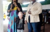 Advance Inclusion for People with Albinism