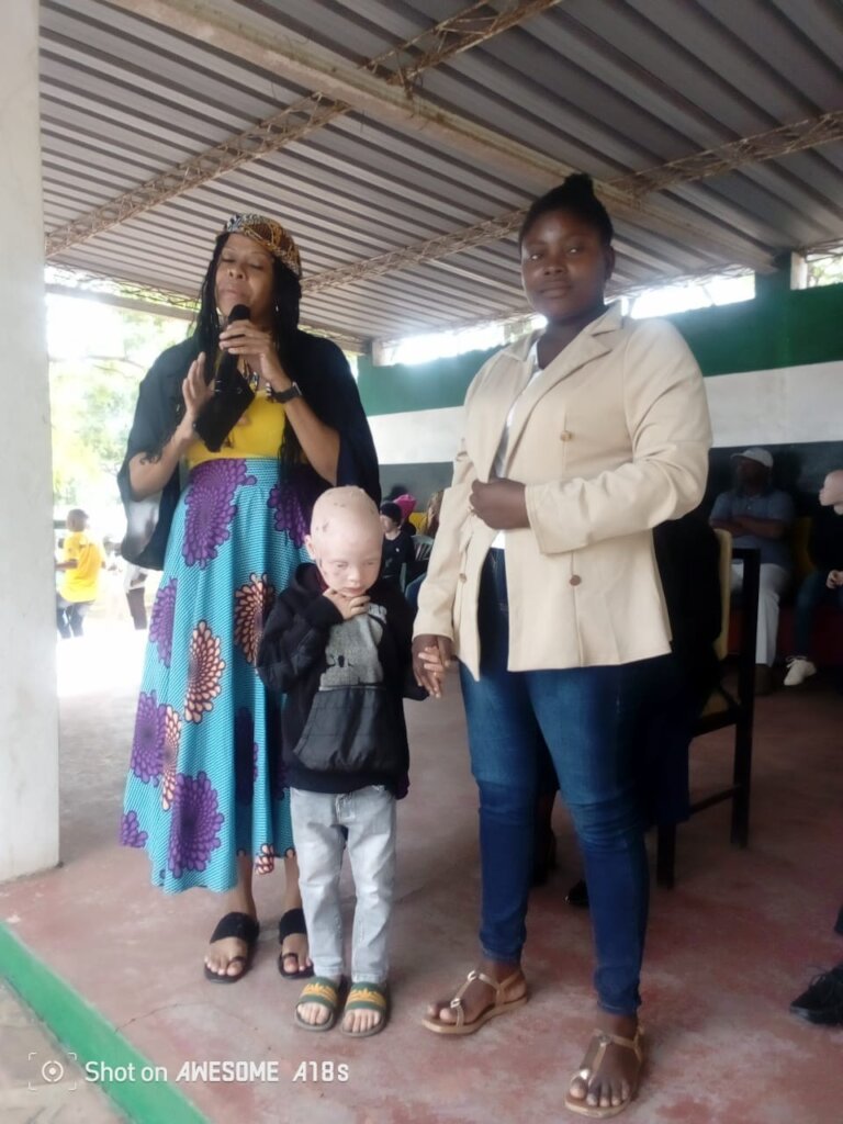 Advance Inclusion for People with Albinism