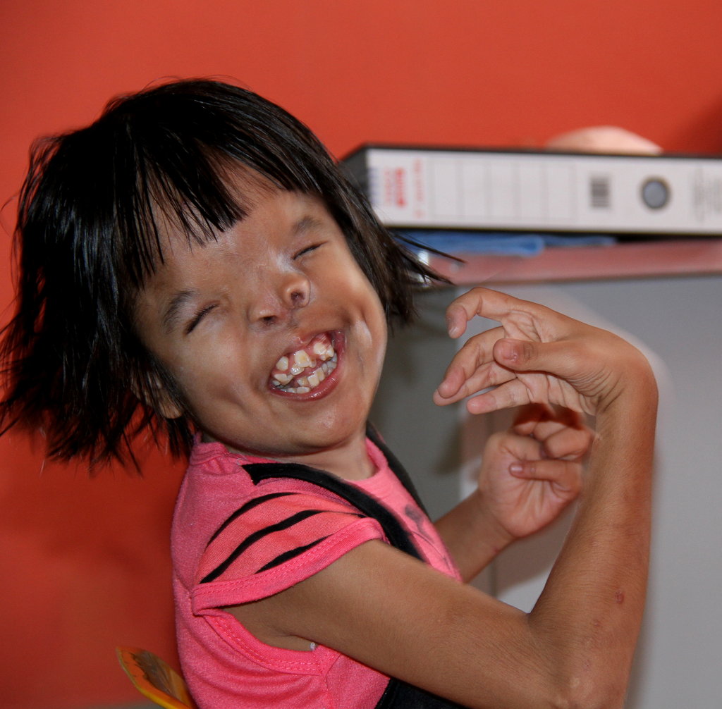 Equip deafblind children with skills for life!