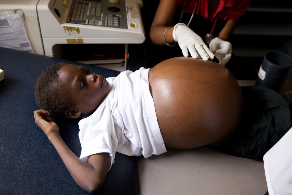 Improve cancer care for 250 children in Malawi