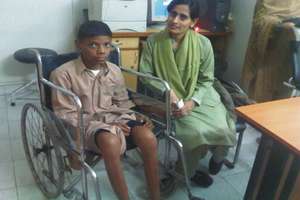Before Treatment