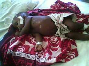 7 month old baby with TB