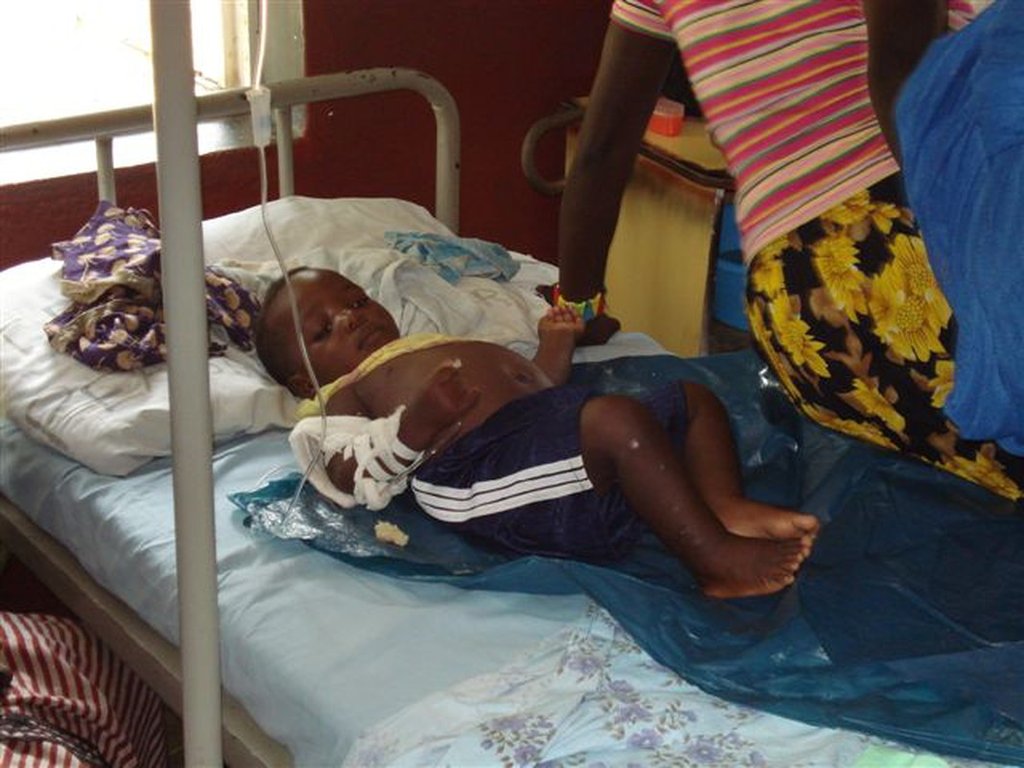 Stop deaths from TB on Likoma Island, Malawi