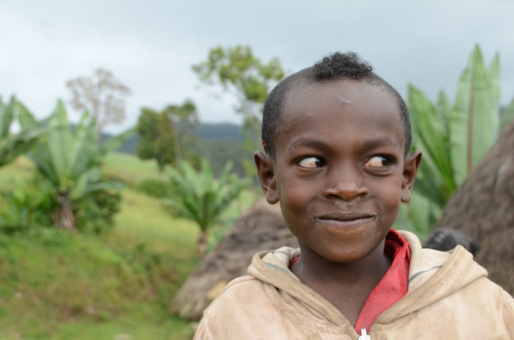 Simple Surgery to Restore Sight in Ethiopia