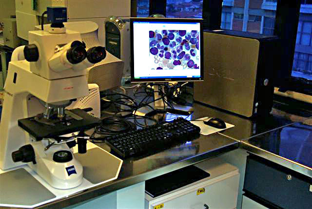 Research and treatment of child cancer in Brazil