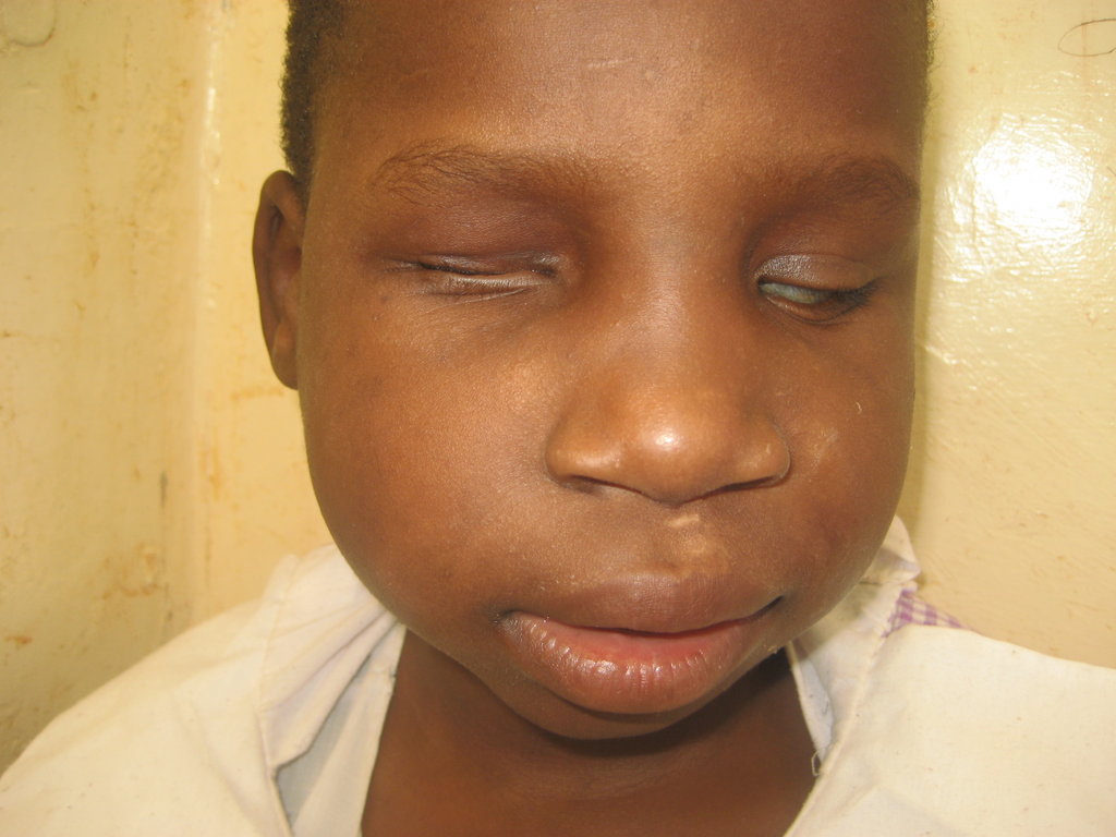Build  Dormitory for 50 Deaf Blind Orphans, Kenya.