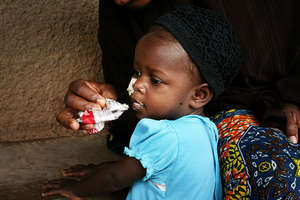 Plumpy'nut brings life and hope to children