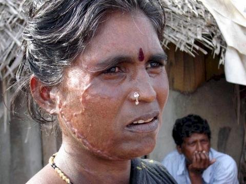 Help prevent disease and starvation in India