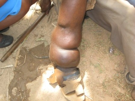 BUILD CHILDRENS HOSPITAL IN UGANDA