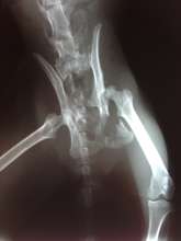 X-Ray of Andy's Pelvis