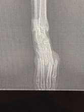 Chester's X-Ray.