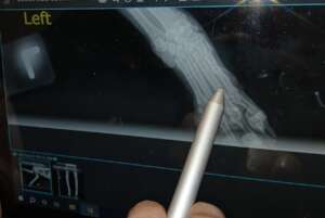Xray