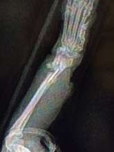 X-Ray 1
