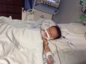 Baby (BB) recovering after surgery