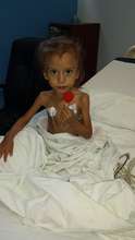 Little Sujeya With Post Op Lollipop