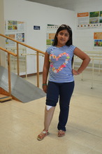 Angelica posing with her new leg!