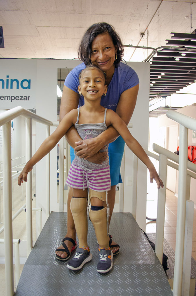 Give prosthetics to low limbs amputees in Colombia