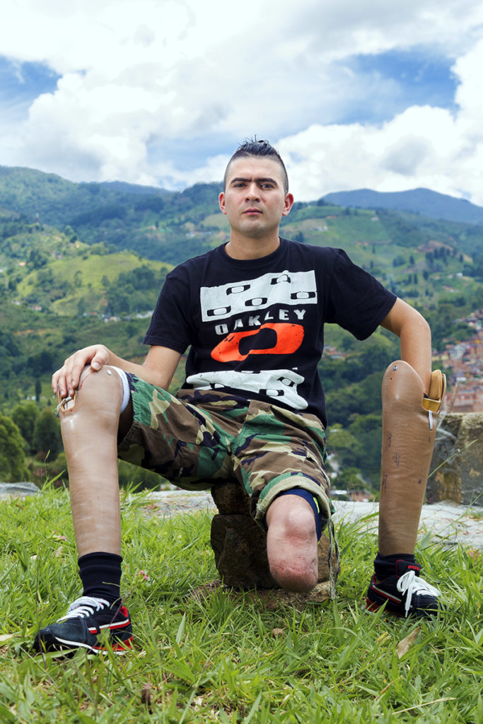 Give prosthetics to low limbs amputees in Colombia