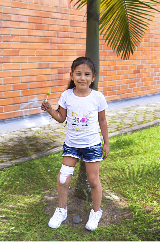 Give prosthetics to low limbs amputees in Colombia