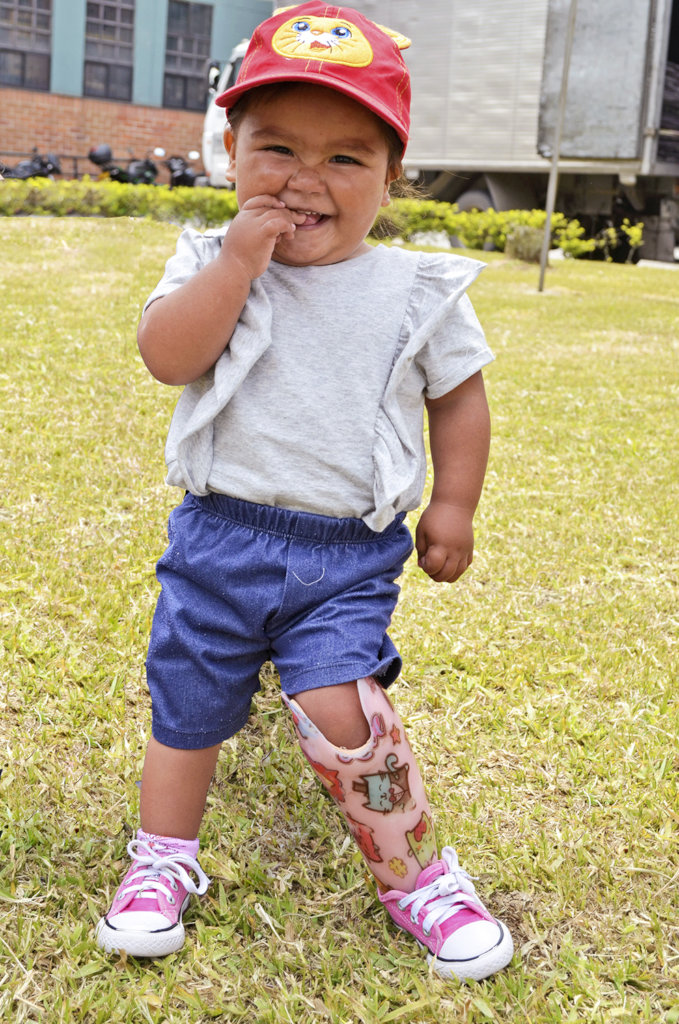 Give prosthetics to low limbs amputees in Colombia