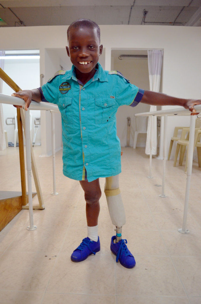 Give prosthetics to low limbs amputees in Colombia