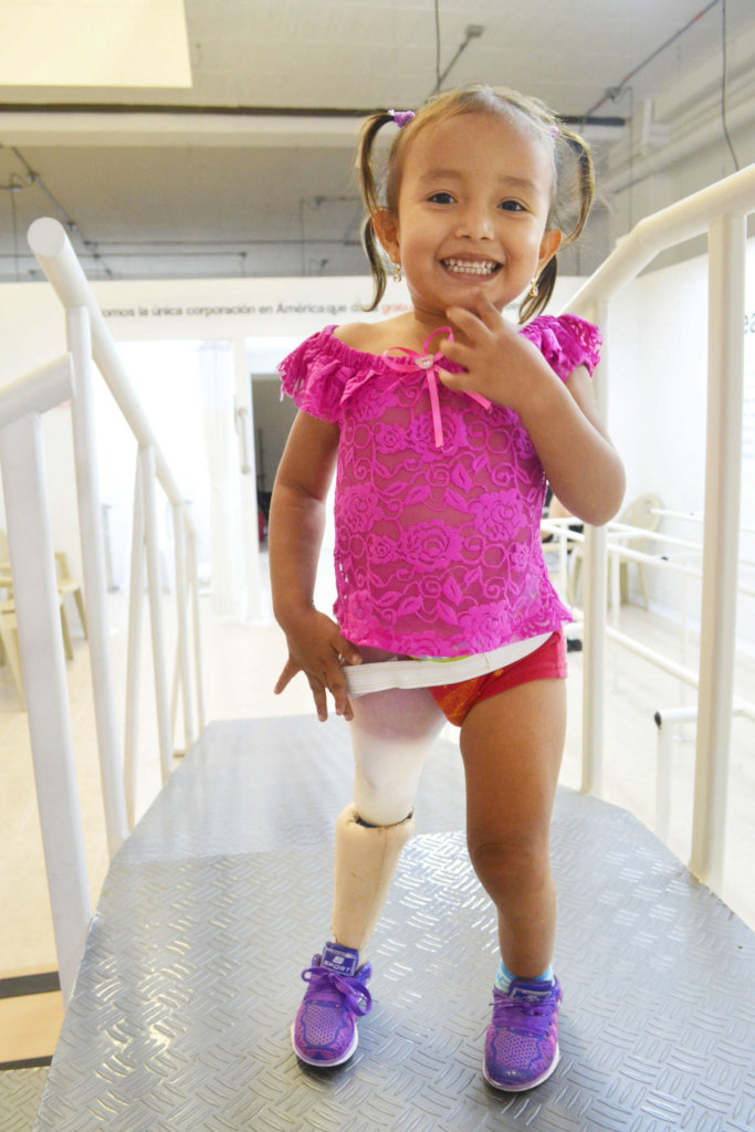 Give prosthetics to low limbs amputees in Colombia