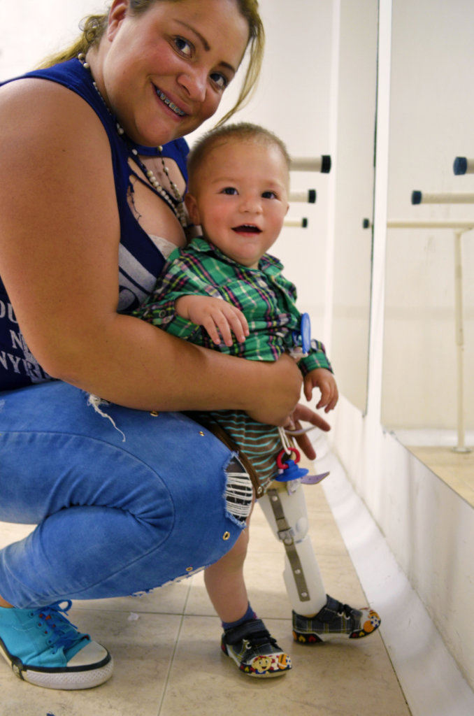 Give prosthetics to low limbs amputees in Colombia