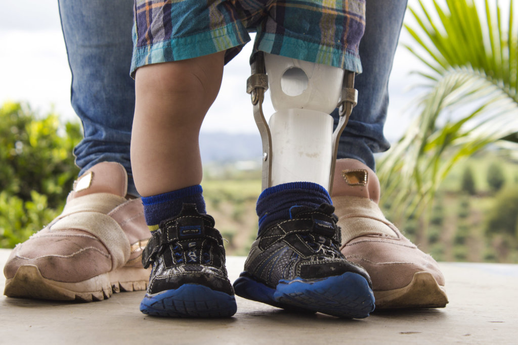 Give prosthetics to low limbs amputees in Colombia