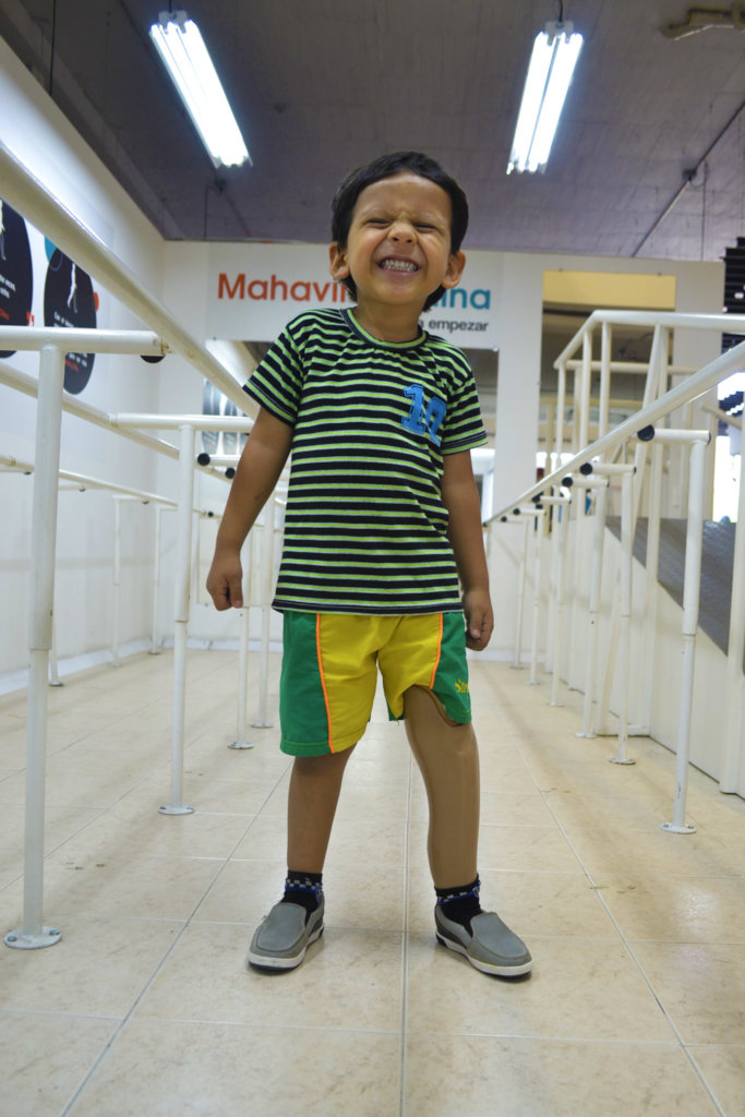Give prosthetics to low limbs amputees in Colombia