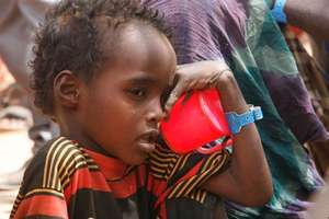 A Somali child awaits malnutrition treatment