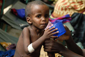 Save Somali Refugee Children from Malnutrition