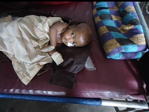 Therapeutic feeding, Ethiopia