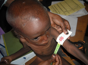 A child is confirmed as malnourished