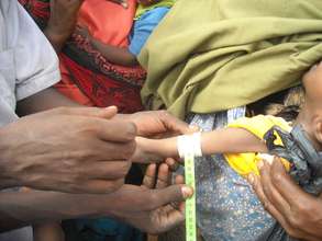 Testing for malnutrition using a MUAC strip
