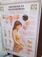 Useful diagram for Karima to deliver babies