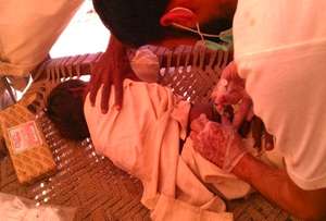 Children are among the most vulnerable