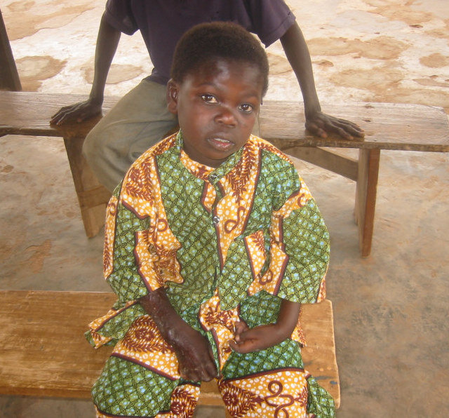 Educate 100 Children with Epilepsy in Ghana