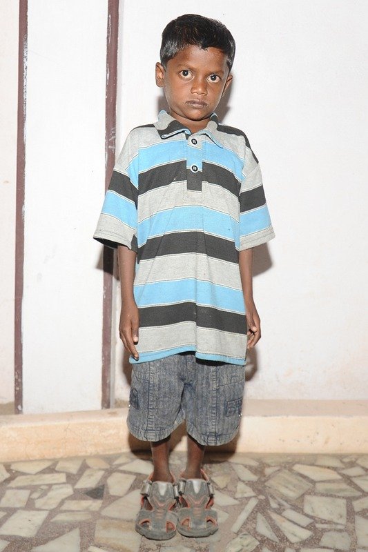 Nourishment for HIV/AIDS Infected Indian Children