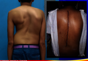 before and after clinical photos of Nathan