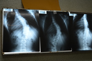 Dominique's xrays