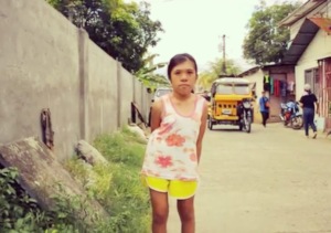 Philippines, patient 14 yrs, pre-surgery, May 2018