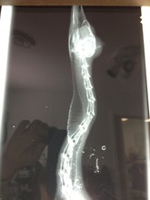 X-ray of merganser showing fracture of skull
