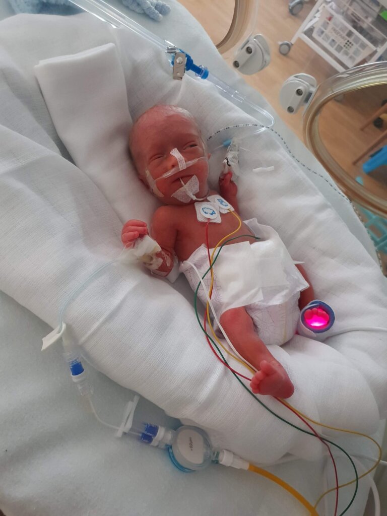James in an incubator in hospital