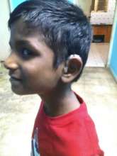 Anand with his hearing aid