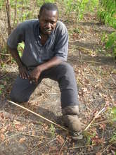 Elephantiasis