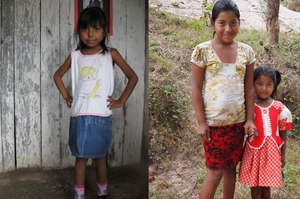 Fatima before treatment (left) & now with sister