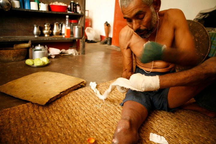 Empowering 1000 Persons in Self Care in India