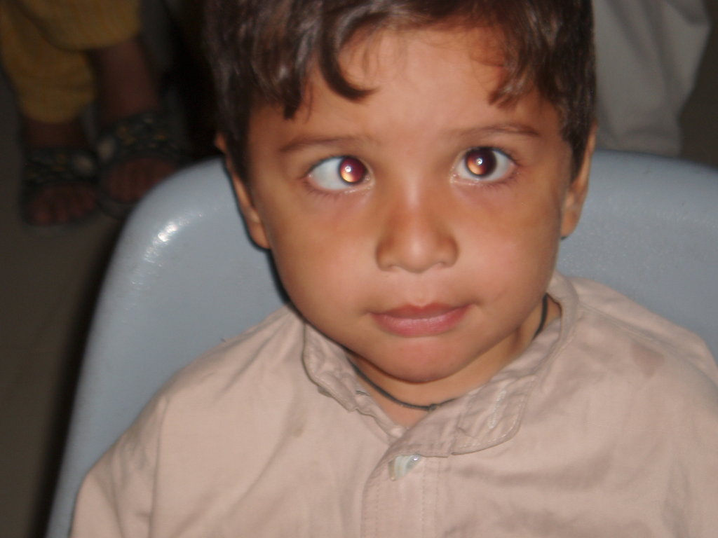 Help the poor blind children in Pakistan See!