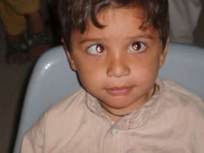 A squint patient