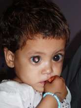 Help the poor blind children in Pakistan See!